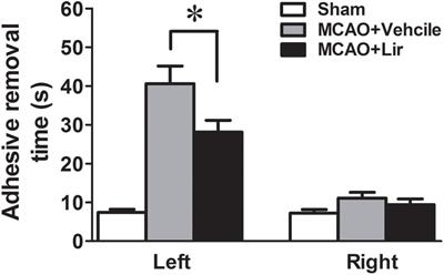 Liraglutide Ameliorates β-Amyloid Deposits and Secondary Damage in the Ipsilateral Thalamus and Sensory Deficits After Focal Cerebral Infarction in Rats